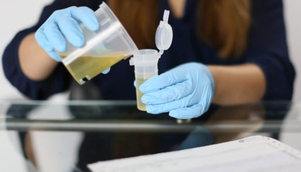 Seven facts about urine drug testing