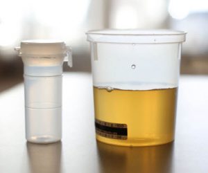 Urine drug test cup